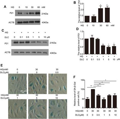 A novel sulfur dioxide probe inhibits high glucose-induced endothelial cell senescence
